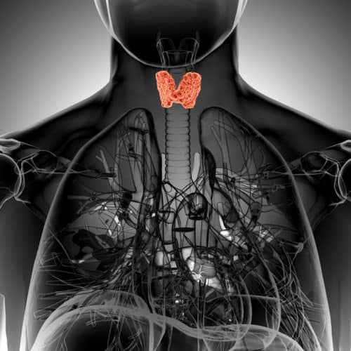 hashimoto's disease