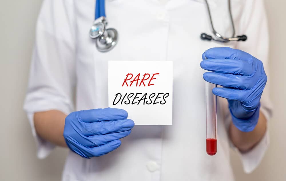 Rare,Diseases,Inscription,Words.,Medical,Concept,Of,Unusual,Disorders.