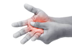 Black and white photo of someone rubbing their right hand with the left hand and red showing pain in the right palm.